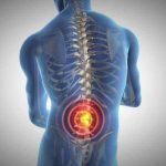 Methods to Strengthen Your Backbone to Fight Again Ache